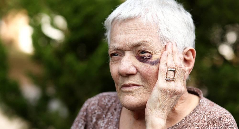 elderly woman with black eye holding hand to her eye